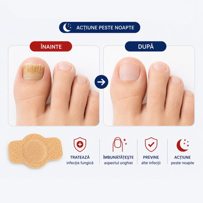 Plasturi Anti Fungici - NailPatch™